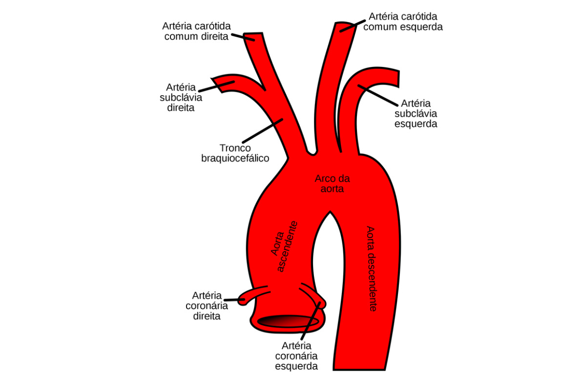 Левая аорта. Ветви дуги аорты анатомия схема. Сосуды дуги аорты анатомия. Брахиоцефальные артерии анатомия. Восходящая аорта дуга аорты.
